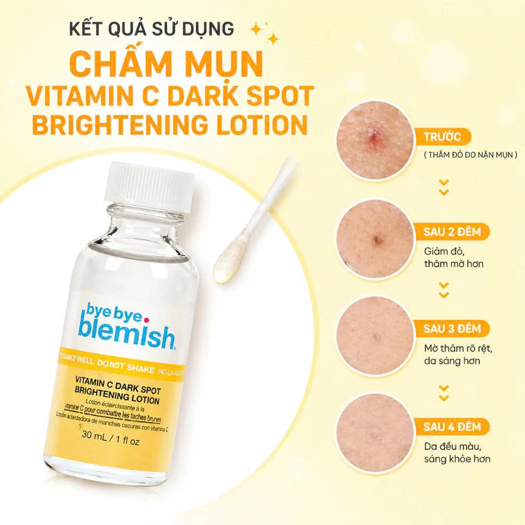 Vitamin C Dark Spot Brightening Cho Da Mụn Thâm