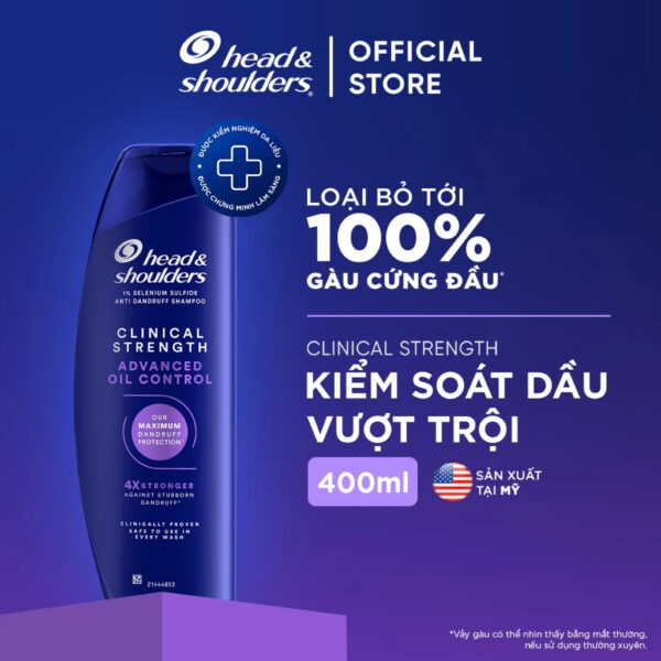 Da đầu dầu nhờn 