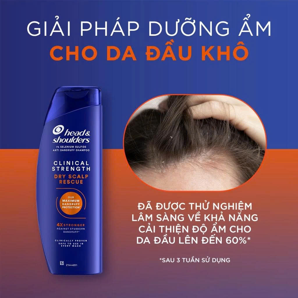 Da đầu khô 