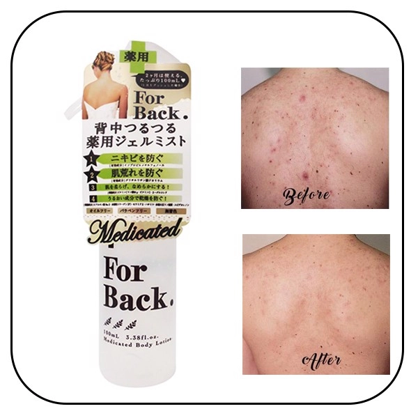 Xịt Làm Giảm Mụn Lưng Pelican For Back Medicated Body Lotion 100ml